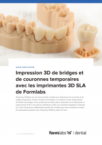Impression 3D de bridges et de couronnes temporaires